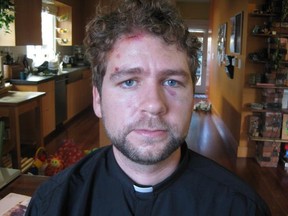 Rev. John Helmiere shows cuts after clash with police at Occupy protest
