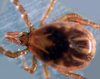 The blackleggedÂ tick (Ixodes scapularis), the primary vector for Lyme disease in the central and eastern United States. (And elsewhere, too. Uploader) (Photo credit: Wikipedia)