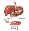 Diagram showing insulin release from the Pancreas and how this lowers blood sugar levels. (Photo credit: Wikipedia)