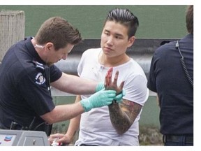 Paramedic checks out the wounded hand of gangster Jeff Chang