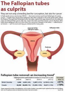 The Fallopian tubes - a culprit in ovarian cancer. 