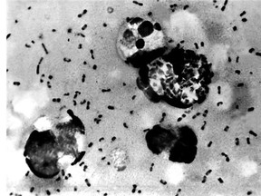 A Centers For Disease Control file image shows bubonic plague bacteria.