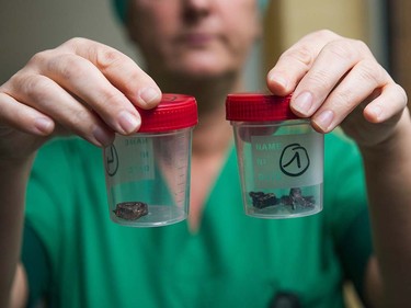 A nurse of the 'Campus Gasthuisberg UZ' hospital in Leuven, outside Brussels, shows fragments of iron shrapnel from a nail bomb, found in victim's bodies, within a visit of the Belgian Royals to the hospital on March 24, 2016, two days after a triple bomb attack, which responsibility was claimed by the Islamic State group, hit Brussels' airport and the Maelbeek - Maalbeek subway station, killing 31 people and wounding 270 others. Belgian authorities are seeking a second suspect over the attack on a metro train in Brussels in which one suicide bomber has already been confirmed dead, police sources told AFP on March 24. LAURIE DIEFFEMBACQ/AFP/Getty Images