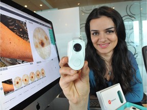 Maryam Sadeghi's MoleScope will be used by Surrey RCMP employees for remote skin screening when working outdoors.