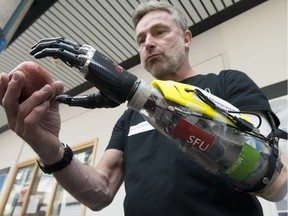 Danny Letain uses a bionic hand to help him eat a apple at Simon Fraser University in Burnaby, B.C. Tuesday, May 3, 2016. When Letain lost his hand in a workplace accident 35 years ago, he never imagined he'd be able to use a bionic hand without invasive surgery. But in October, the parathlete will test a new robotic prosthesis developed by researchers at Simon Fraser University at the world's first cyborg Olympics in Zurich.