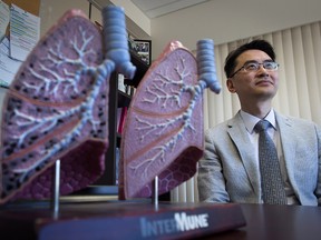 A model of a lung with chronic obstructive pulmonary disease, left, is displayed with a healthy lung as Dr. Don Sin, Head of the Respiratory Division at St. Paul's Hospital, sits for a photograph in Vancouver, B.C., on Thursday August 25, 2016. Millions of people who feel like they're suffocating from the symptoms of a lung disease could benefit from a new website its creator considers a crystal ball for helping doctors calculate how a patient's condition could deteriorate and intervene with tailored therapies.