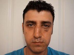 Dino Demir of Surrey says he was assaulted after a fellow West End Starbucks patron punched him in the face after yelling racist comments like, "go back to your country," when Demir was talking on the phone in Turkish.