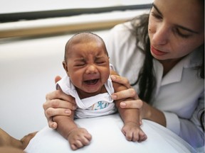 A six-week-old baby born with microcephaly in Brazil. More than 2,000 children have been born with microcephaly in Brazil since the beginning of 2016, according to the country's ministry of health.
