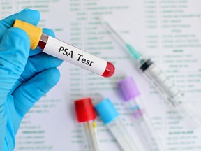 Blood sample for PSA (Prostate-specific antigen) testing [PNG Merlin Archive]