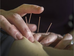 Acupuncture was officially recognized in B.C. in 1996.