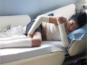 John Chen, an 11-year-old boy from Richmond, has been in hospital since March being treated for necrotizing fasciitis (flesh-eating disease).