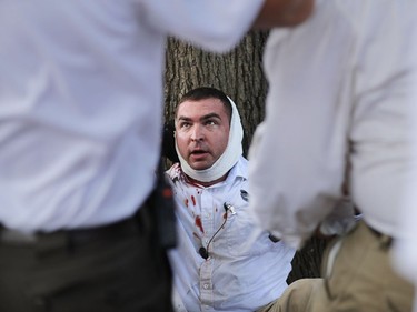 CHARLOTTESVILLE, VA - AUGUST 12:  A man has his bloody head bandaged by fellow white nationalists, neo-Nazis and members of the "alt-right" during the "Unite the Right" in Lee Park August 12, 2017 in Charlottesville, Virginia. After clashes with anti-fascist protesters and police the rally was declared an unlawful gathering and people were forced out of Lee Park, where a statue of Confederate General Robert E. Lee is slated to be removed.