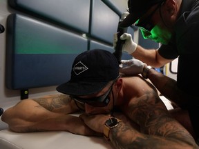 Sasha Elez (right), owner of Tattoo Medic, works to remove a tattoo from Spencer King's back in Saskatoon.