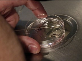 FILE PHOTO - Embryologist Rick Slifkin demonstrates fertilization techniques on a nonviable embryo at Reproductive Medicine Associates of New York, in New York.