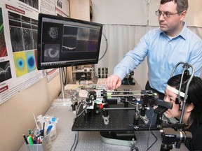 Simon Fraser University engineering science Prof. Marinko Sarunic demonstrates an early prototype of a scanner to diagnose eye diseases and prevent vision loss in this undated handout photo.