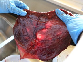 In this 2013 photo, a placenta is prepared for a new mother to eat.