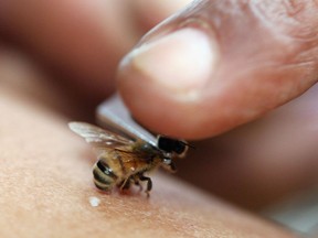 Live bee acupuncture, which was first practiced in China, has developed as a popular alternative healing method in Indonesia.