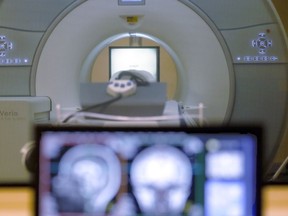 FILE - In this Nov. 26, 2014 file photo, a brain-scanning MRI machine at Carnegie Mellon University in Pittsburgh.