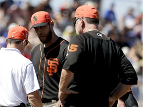 San Francisco Giants starting pitcher Madison Bumgarner, center, is looked over by manager Bruce Bochy, right, and a trainer after getting hit in the hand during the third inning of a spring baseball game against the Kansas City Royals in Scottsdale, Ariz., Friday, March 23, 2018.