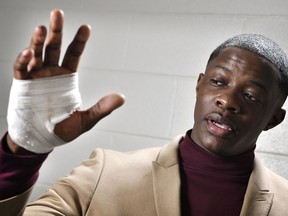 James Shaw Jr., shows his hand that was injured when he disarmed a shooter inside a Waffle House on Sunday, April 22, 2018, in Nashville, Tenn. A gunman stormed the Waffle House restaurant and shot several people to death before dawn, according to police, who credited Shaw, a customer with saving lives by wresting the assailant's weapon away.