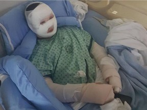 Eleven-year-old Presley Paterson of 100 Mile House recovering in B.C. Children's Hospital after severe burns from a faulty science experiment.
