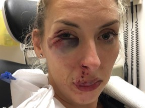 Shawn Jones was injured on Oct. 7, 2018 while walking on Main Street after work. She says, after being confronted by a stranger, he pushed her to the ground.