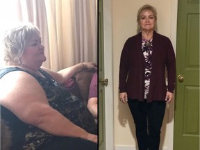 Sheila Vataiki had bariatric surgery to address her obesity and diabetes.