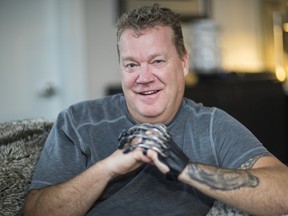 Erik Bjarnason, at home in North Vancouver, wearing his new prosthetic hand.
Francis Georgian