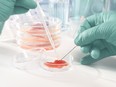 A researcher observes meat cultured in a laboratory. Chinese researchers have used gene-edited stem cells to cure a patient's leukemia, much after a scientist controversially used the same method to edit the genes of unborn babies.