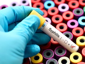 jarun011/iStock/Getty Images Plus Syphilis stock photo ORG XMIT: POS1905031328470811