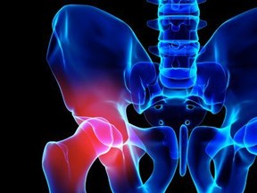 Centric Health Surgical Centre Toronto uses the direct anterior approach for hip replacements, which results in quicker recovery and less post-op pain compared to traditional hip replacement methods.