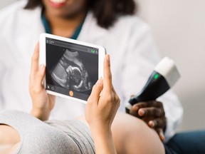 Clarius Mobile Health has launched a line of ultrasound scanners that combine artificial intelligence and a pocket size to make medical ultrasounds accessible to medical professionals.