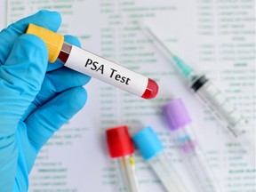 Blood sample for PSA (prostate-specific antigen) testing.