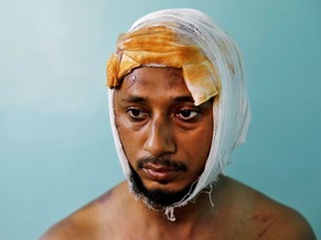 Mohammad Zubair, 37, who is Muslim and was injured after being beaten by a group of men chanting pro-Hindu slogans during protests sparked by a new citizenship law, sits inside his relative's house in New Delhi, India, February 26, 2020. "They saw I was alone, they saw my cap, beard, shalwar kameez (clothes) and saw me as a Muslim," said Zubair. "They just started attacking, shouting slogans. What kind of humanity is this?" REUTERS/Danish Siddiqui  SEARCH "DANISH STORY" FOR THIS STORY. SEARCH "WIDER IMAGE" FOR ALL STORIES. TPX IMAGES OF THE DAY.