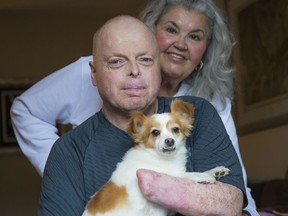 Rick Thompson, shown here with his wife Rita, lost his hands and legs to bacterial meningitis in 2015. He's hoping doctors in Ontario can give him a new set of hands through Canada's first hand transplant.