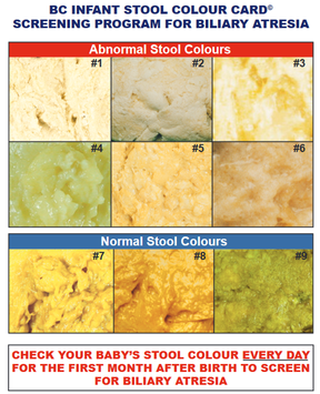 Sponsored: Recognize the warning signs of liver disease in newborns