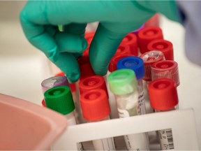 SEATTLE, WASHINGTON - MARCH 13: A medical Laboratory scientist tests vials of samples for coronavirus at the University of Washington Medicine virology lab on March 13, 2020 in Seattle, Washington. The lab is processing about 1,500 tests for COVID-19 daily and hopes to increase to 5000 in the following weeks. (Photo by John Moore/Getty Images) ORG XMIT: 775494071