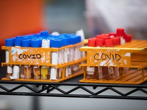 A new Angus Reid poll shows where Canadians stand on the economic impacts prompted by COVID-19. Specimens to be tested for COVID-19 are seen at LifeLabs after being logged upon receipt at the company's lab, in Surrey, B.C., on Thursday, March 26, 2020.