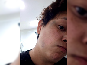 Vancouver police are investigating after an indigenous woman was mistaken for Asian and punched in the head after a man heard her sneeze. Dakota Holmes, 27, is pictured with bruising on her temple and jaw after the May 15 attack.