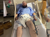 A crowdfunding campaign has been launched to help a Vancouver man who spoke up to anti-gay demonstrators in the West End and was assaulted and left with a broken leg. Justin Morissette is pictured in hospital with a broken left leg. He remains in hospital on Monday.