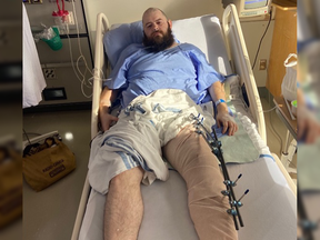 A crowdfunding campaign has been launched to help a Vancouver man who spoke up to anti-gay demonstrators in the West End and was allegedly assaulted and left with a broken leg. Justin Morissette is pictured in hospital with a broken left leg. He remains in hospital on Monday.