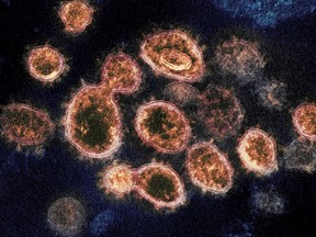 The SARS-CoV-2 virus particles, which cause COVID-19, isolated from a patient in the U.S., emerging from the surface of cells cultured in a lab in a 2020 electron microscope image provided by the National Institute of Allergy and Infectious Diseases - Rocky Mountain Laboratories.