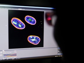 A researcher observes the confocal image on a screen showing the nucleus of human stem cells after KAT7 intervention, in the Aging and Regeneration lab at the Institute for Stem Cell and Regeneration of the Chinese Academy of Sciences (CAS) in Beijing, China, Jan. 12, 2021.