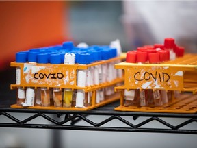 Specimens to be tested for COVID-19 are seen at LifeLabs in March 2020.