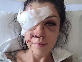 Regina Hampson was shot in the hand and face on Saturday.
