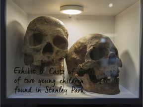 Pictured is a cast of the skulls of two children that were found in Stanley Park in 1953. The case became known as the babes-in-the-woods murders, and was never solved.