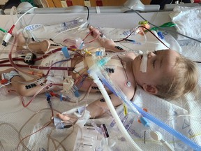 Six-month-old James Lazeski is sedated, intubated and with his LVAD (left ventricular assist device) Mazankowski Alberta Heart Institute in Edmonton in August 2021.