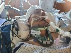 Dale Lilik, 38, was seriously injured when he was hit by a car on April 26. As of April 30, he was in an induced coma at the Royal Columbia Hospital.