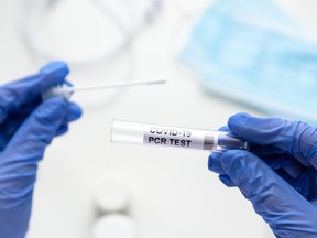 Test to coronavirus in doctor hands, nurse holds tube of COVID-19 swab collection kit in laboratory. Concept of corona virus diagnostics, nasal and oral PCR testing and cure during COVID pandemic.