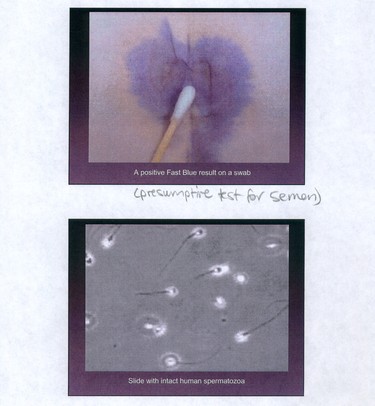 Presumptive test for semen. Images entered in court by lab technologists who examined the evidence seized from Robert Pickton's farm for biological evidence such as blood, semen, DNA and hair.